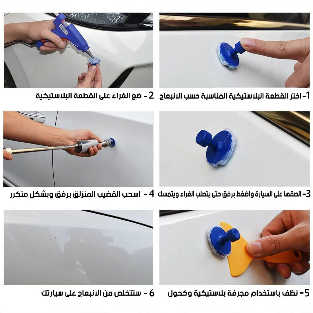 أداة إزالة خدوش السيارة – طقم كامل